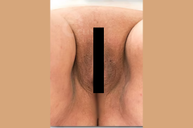 4 4
